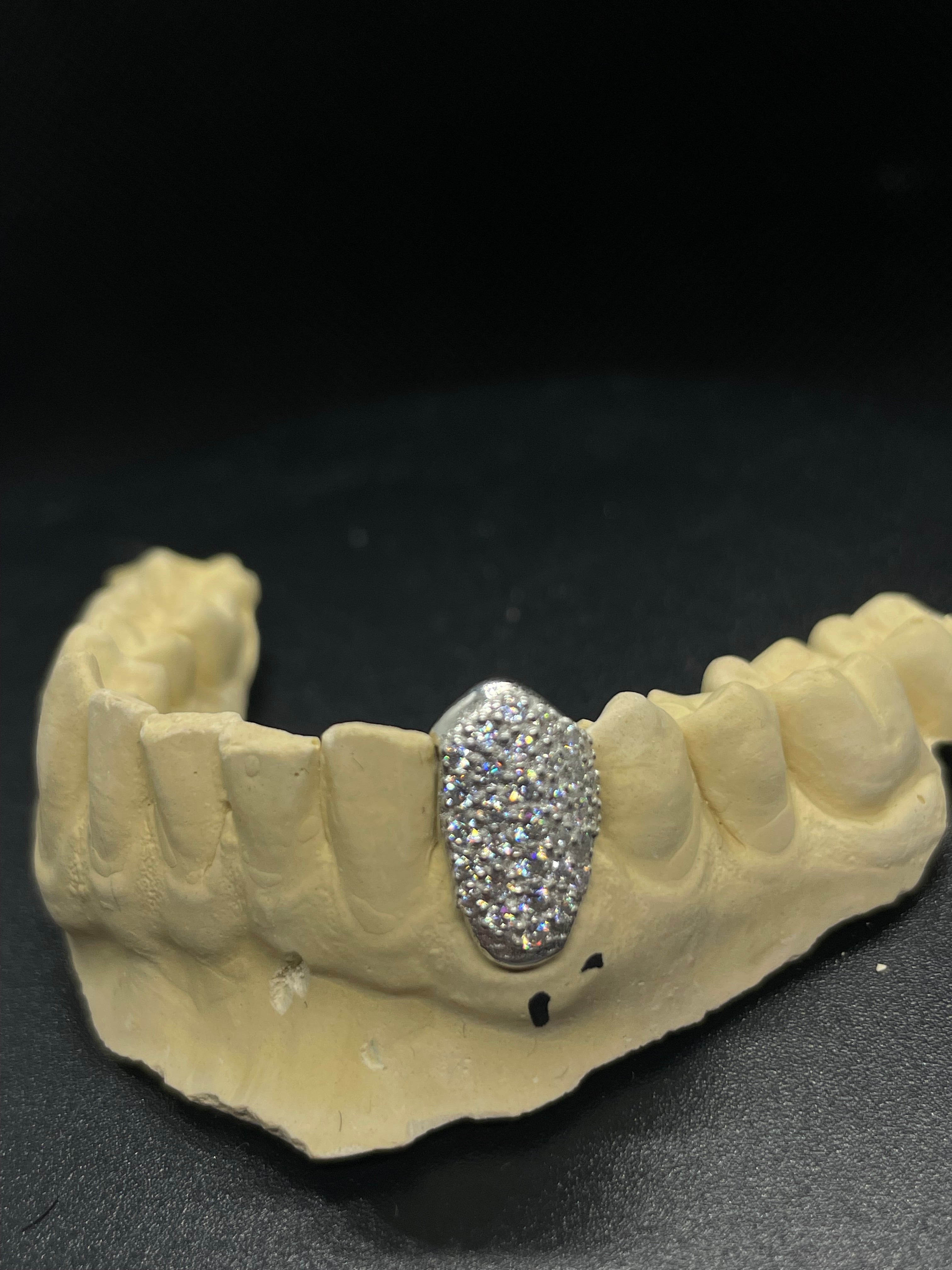 Single VVS Tooth Cap