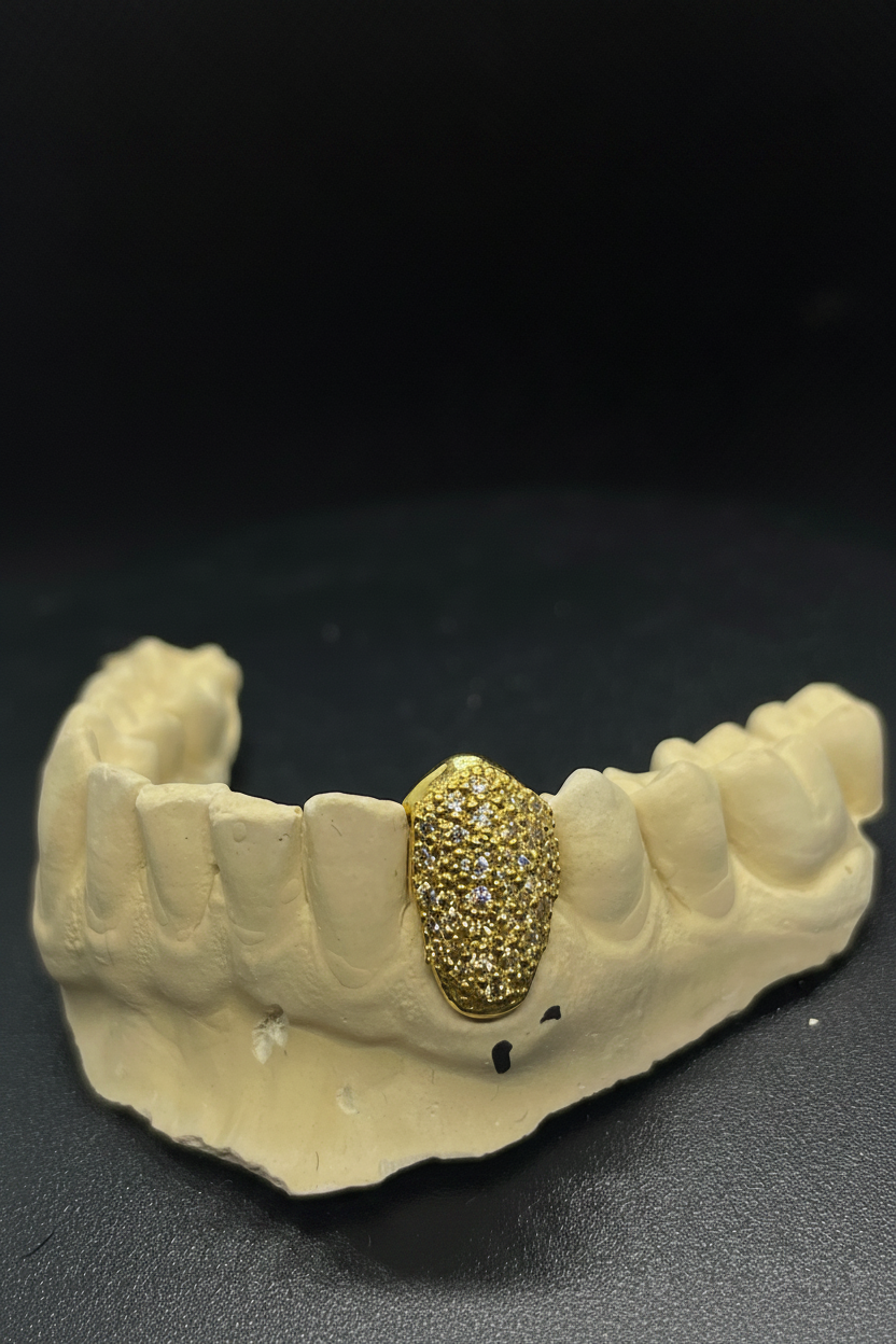 Single VVS Tooth Cap