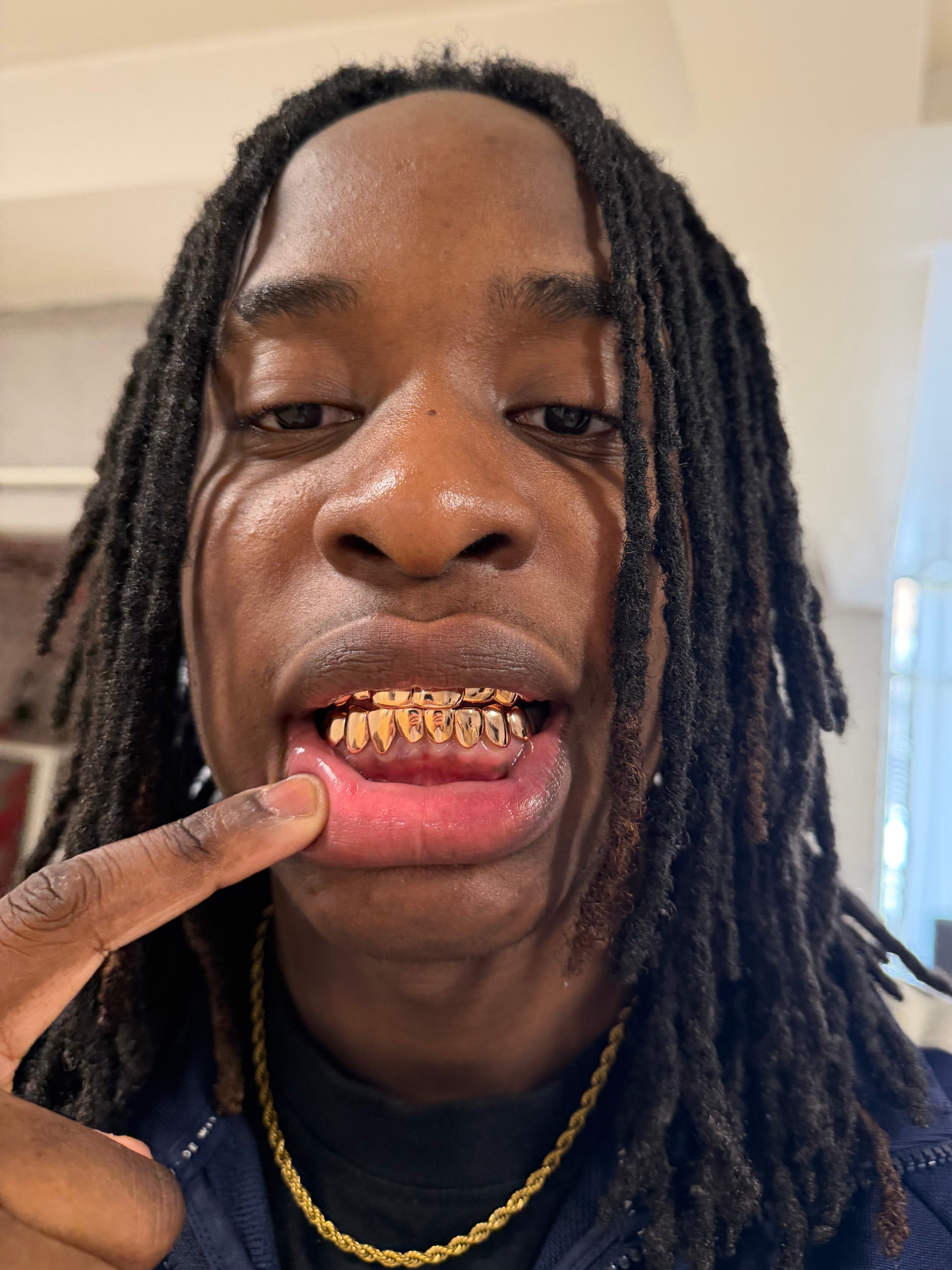Rose Gold Grillz