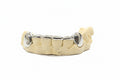 Silver Bridge Grillz
