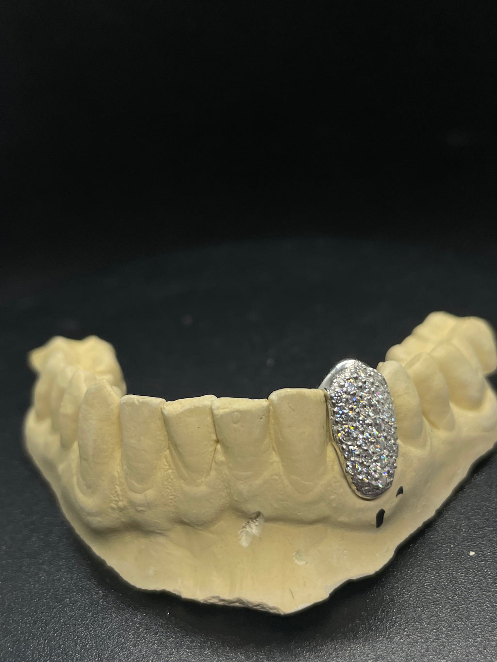 Single VVS Tooth Cap